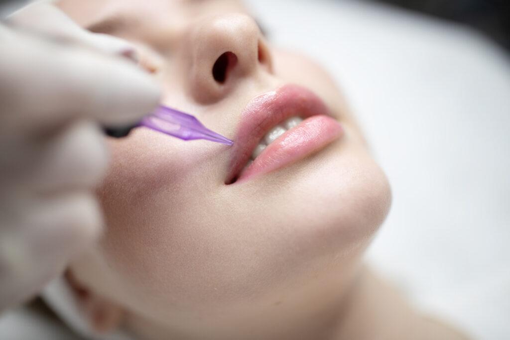 A Caucasian woman is experiencing a permanent makeup procedure at a beauty salon. The technician carefully applies a purple tool near her lips for a long-lasting enhancement.