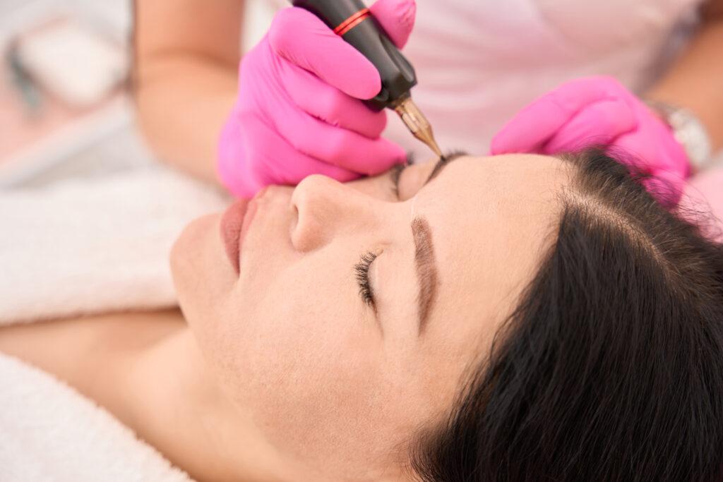 Hair Removal